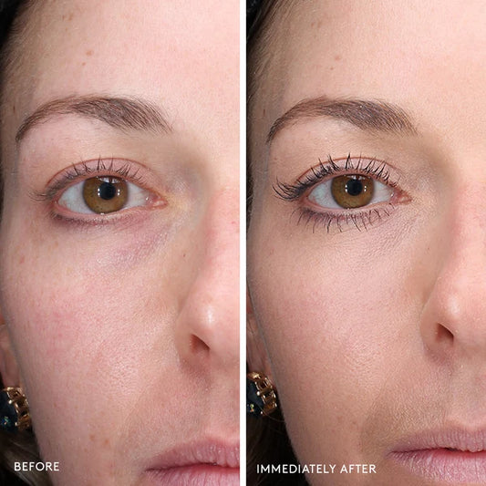 Total Eye 3-in-1 clinical study results